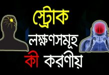 স্ট্রোক কি? স্ট্রোকের লক্ষন ও উপস্বর্গসমূহ | স্ট্রোক প্রতিরোধে যা যা করণীয় স্ট্রোক কি ? স্ট্রোকের লক্ষন ও উপস্বর্গসমূহ | স্ট্রোক প্রতিরোধে যা যা করণীয় | Strokes Treatments